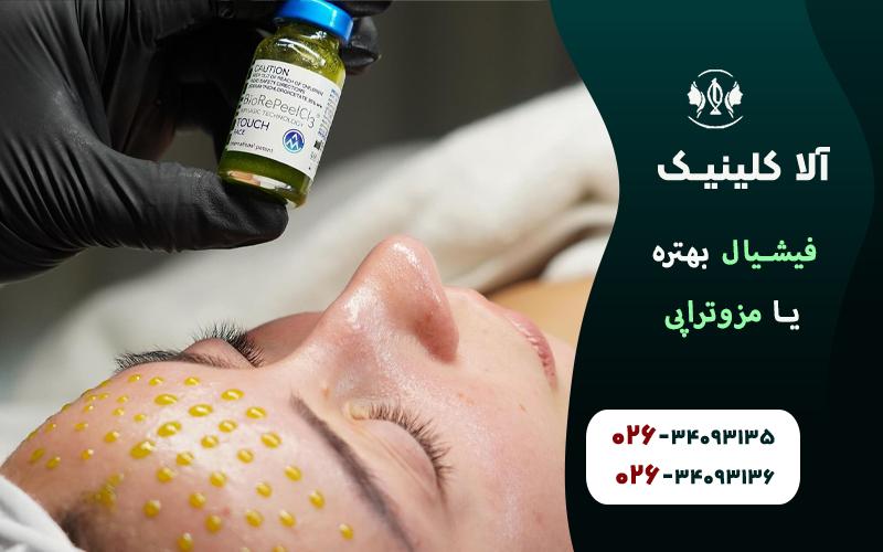 فیشیال بهتره یا مزوتراپی