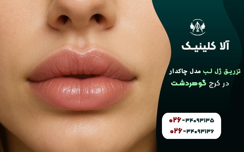 ژل لب مدل روسی چاک دار