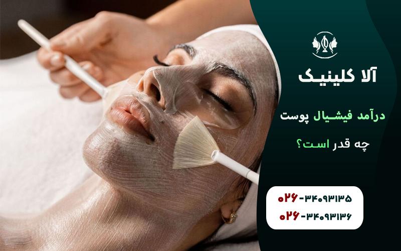 درامد فیشیال پوست چقدر است