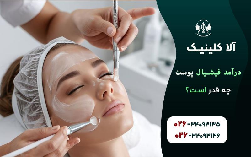 درامد فیشیال پوست چقدر است