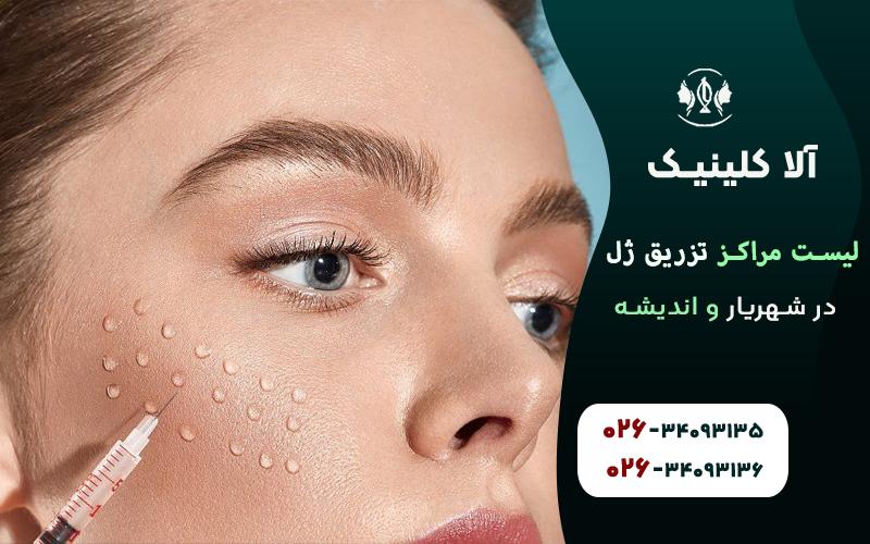 لیست مراکز تزریق ژل در شهریار و اندیشه