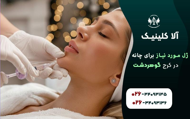 چند سی سی ژل برای چانه لازم است؟