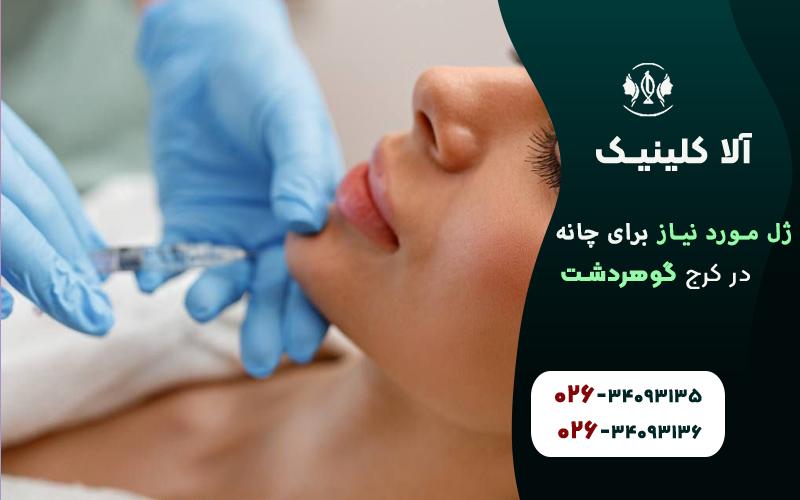 چند سی سی ژل برای چانه لازم است؟