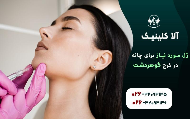 چند سی سی ژل برای چانه لازم است؟