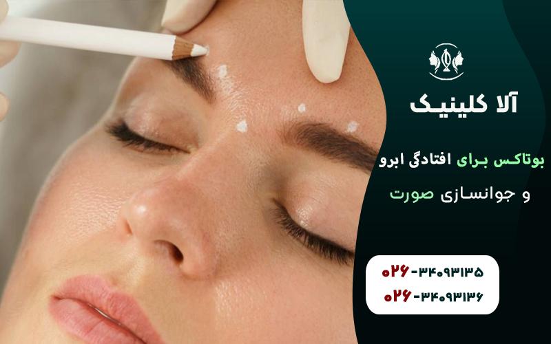 بوتاکس برای افتادگی ابرو و جوانسازی صورت