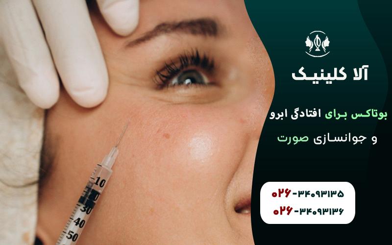 بوتاکس برای افتادگی ابرو و جوانسازی صورت