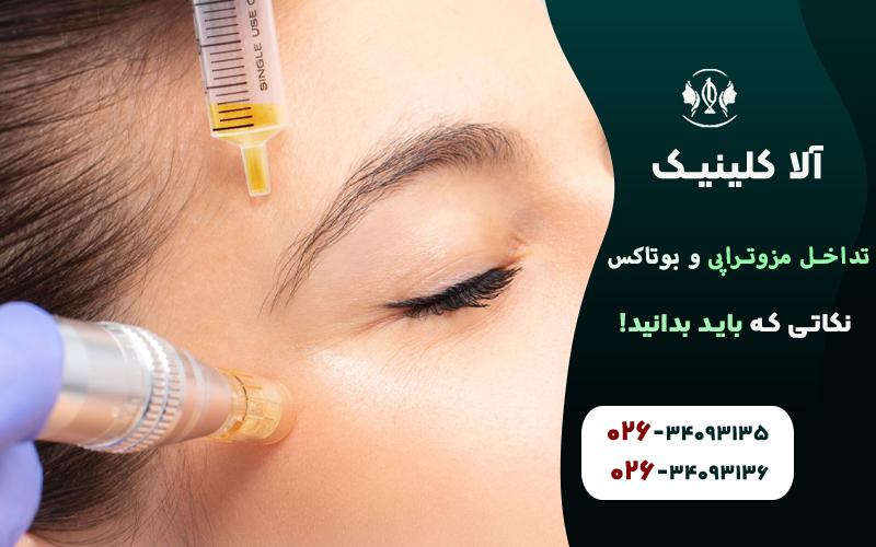 تداخل مزوتراپی و بوتاکس نکاتی که باید بدانید!