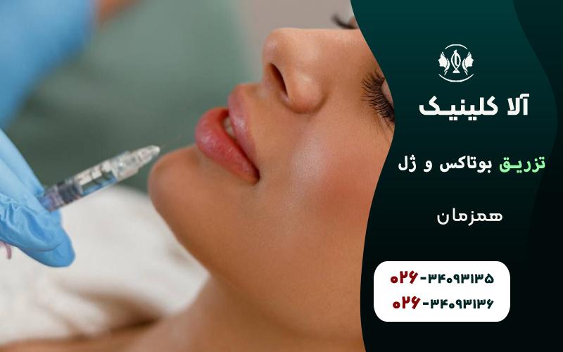 تزریق بوتاکس و ژل همزمان