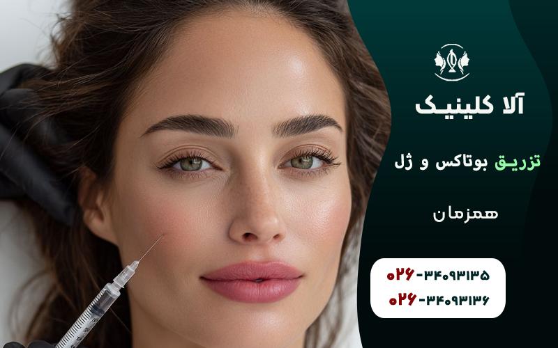 تزریق بوتاکس و ژل همزمان + سوالاتی که دارید!