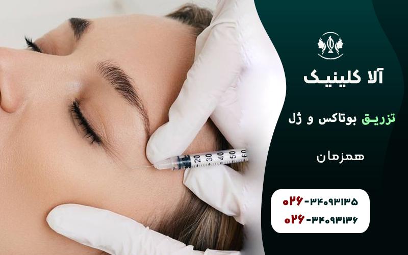 تزریق بوتاکس و ژل همزمان