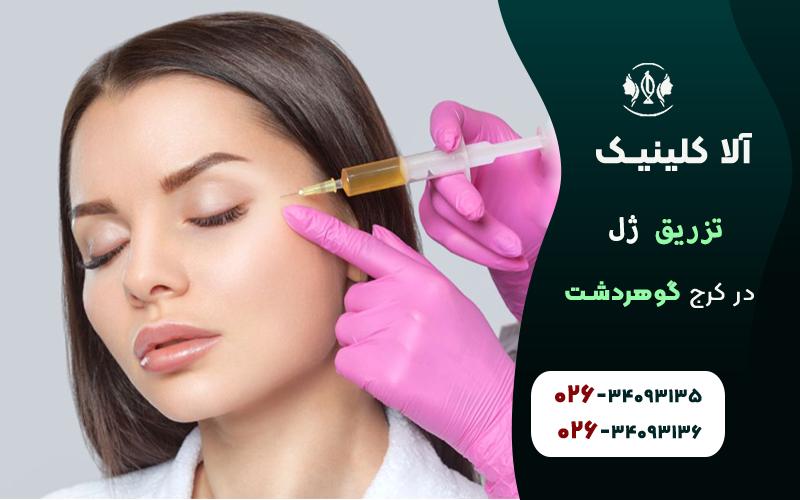 بهترین کلینیک تزریق ژل در کرج