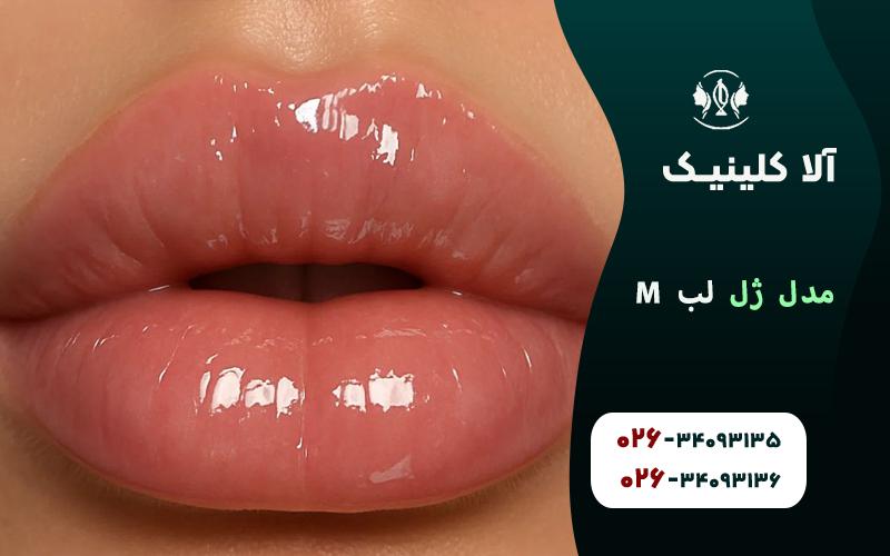 مدل ژل لب ام