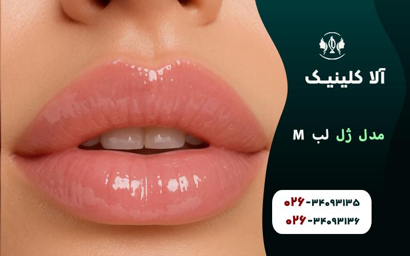مدل ژل لب M