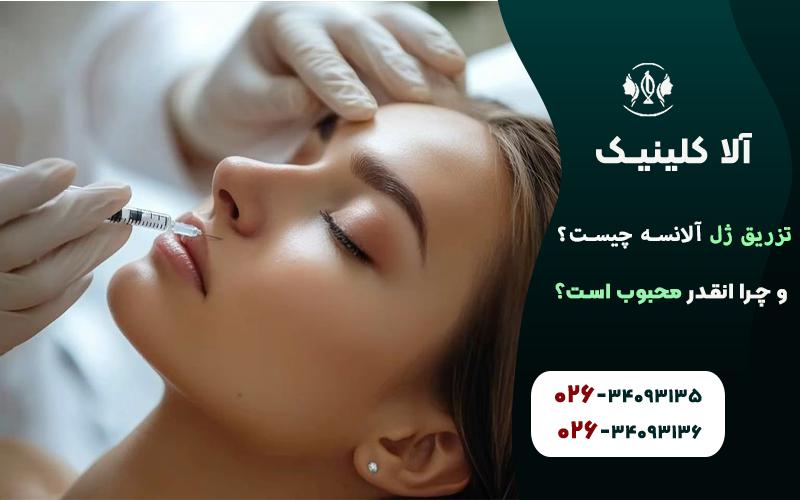 تزریق ژل الانسه چیست و چرا انقدر محبوب است؟