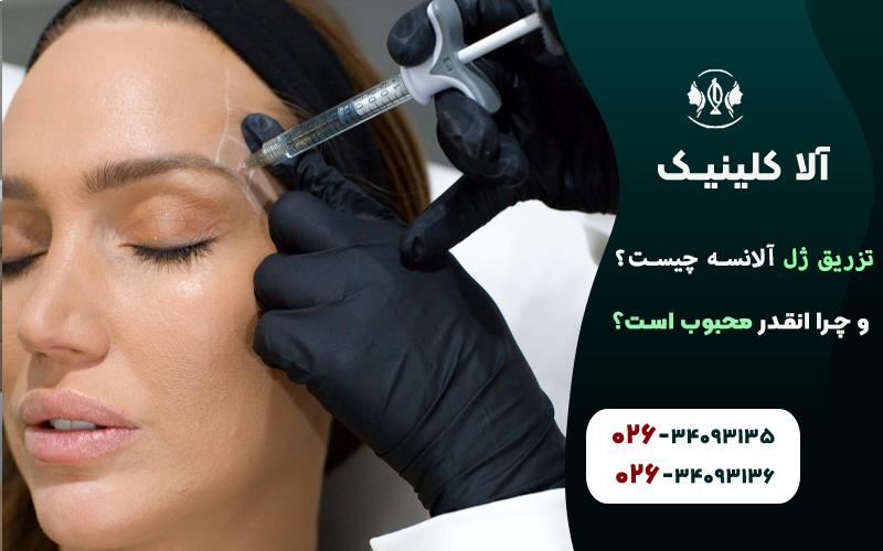 تزریق ژل الانسه چیست