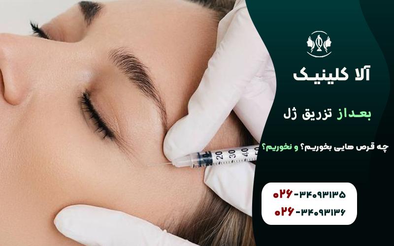 بعد از تزریق ژل چه قرص هایی بخوریم؟ چه قرص هایی نخوریم!؟