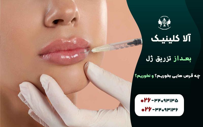 بعد از تزریق ژل چه قرص هایی بخوریم؟ چه قرص هایی نخوریم!؟