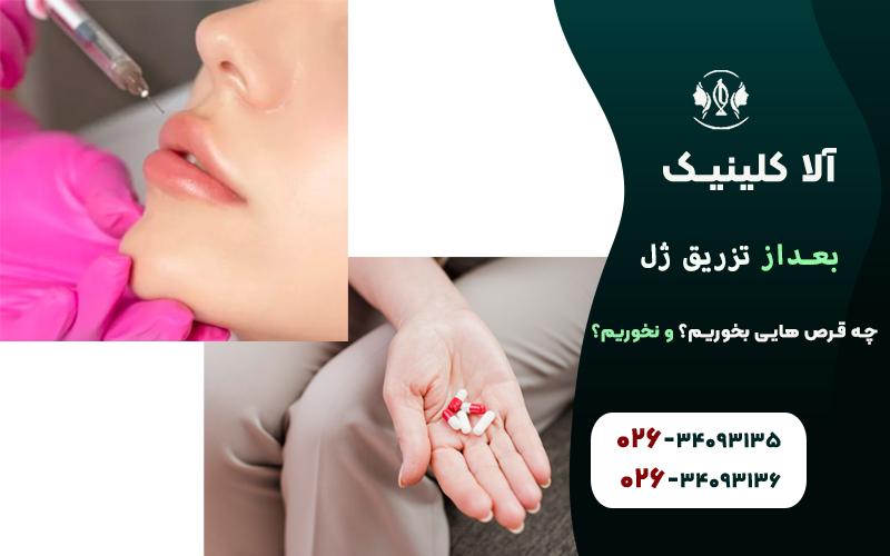 بعد از تزریق ژل چه قرص هایی بخوریم؟ چه قرص هایی نخوریم!؟