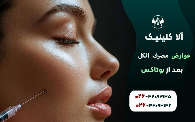 مراقبتهای لازم پس از بوتاکس