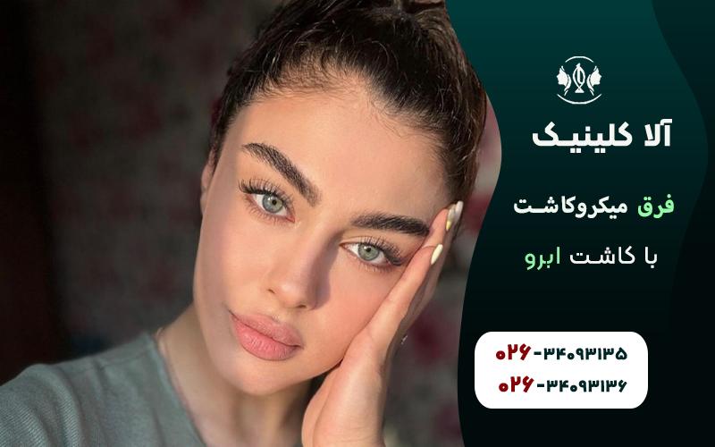فرق میکرو کاشت با کاشت ابرو