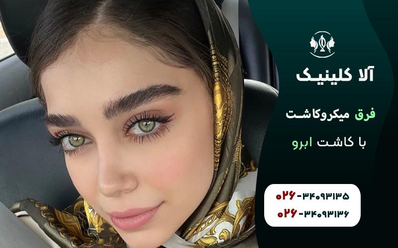 فرق میکرو کاشت با کاشت ابرو