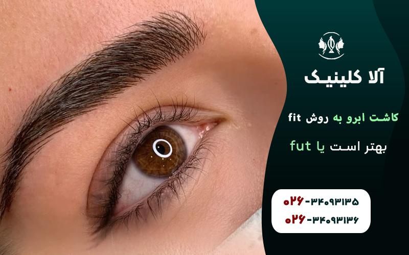 کاشت ابرو به روش fit بهتر است یا fut