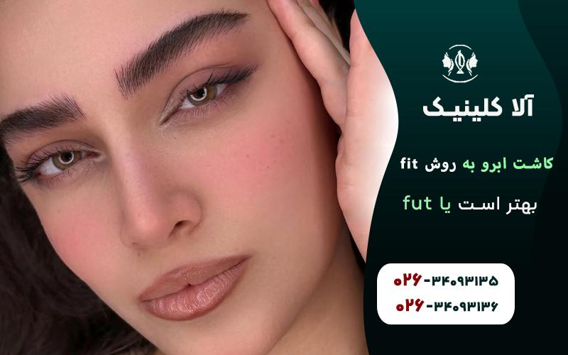 مقایسه کاشت ابرو به روش fit و fut