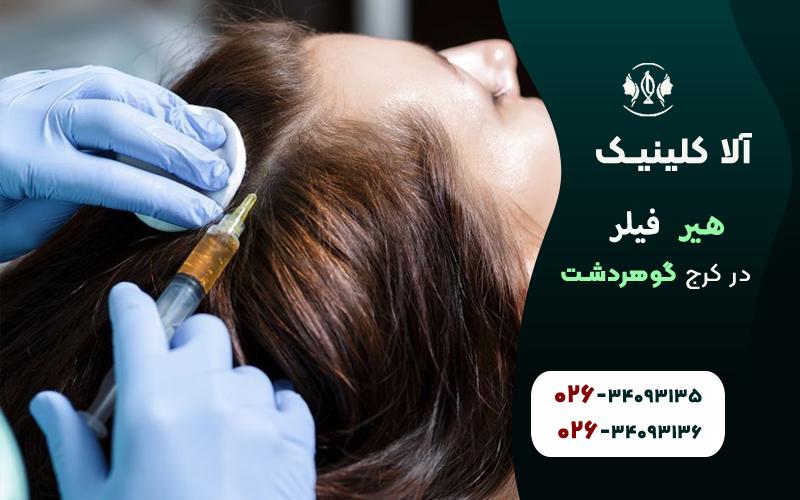 بهترین کلینیک برای خدمات هیر فیلر در کرج
