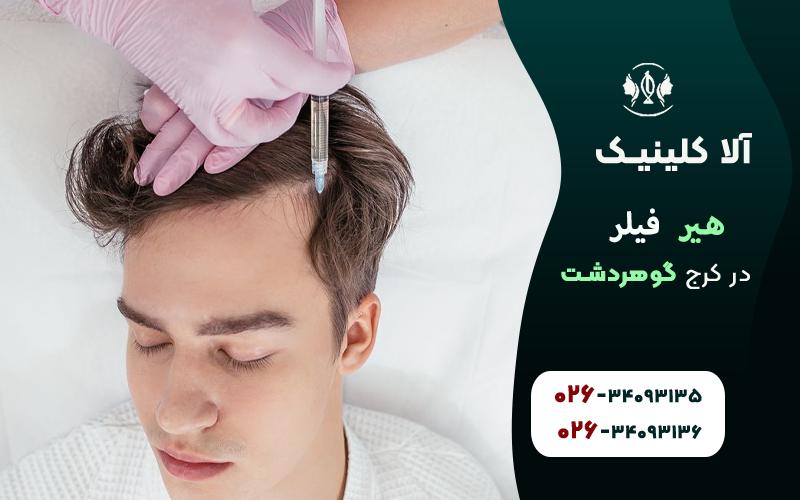 خدمات هیر فیلر در کرج