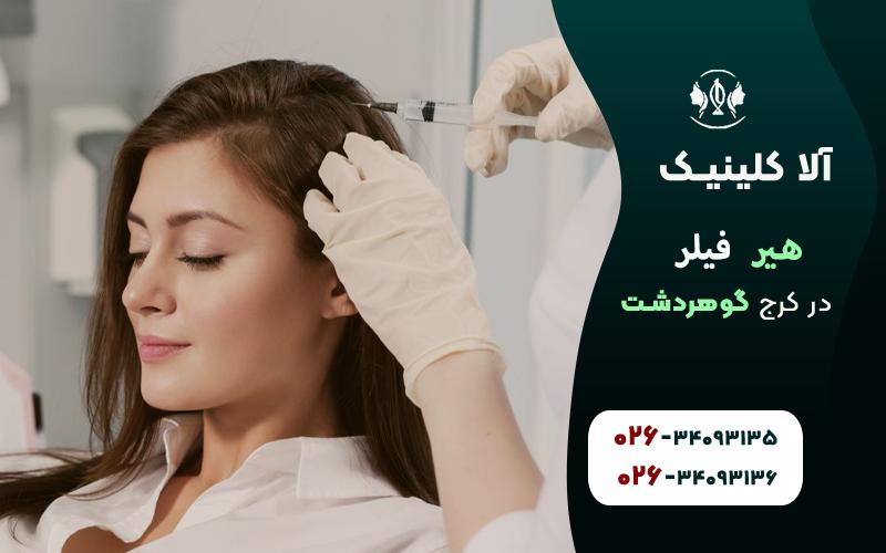 هیر فیلر برای رشد مو
