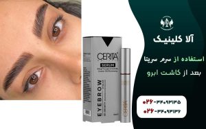 استفاده از سرم سریتا بعد از کاشت ابرو