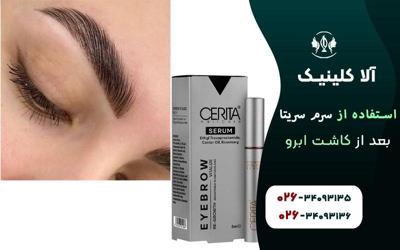 فواید استفاده از سرم سریتا بعد از کاشت ابرو