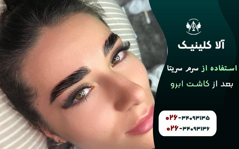 استفاده منظم از سرم سریتا بعد از کاشت ابرو