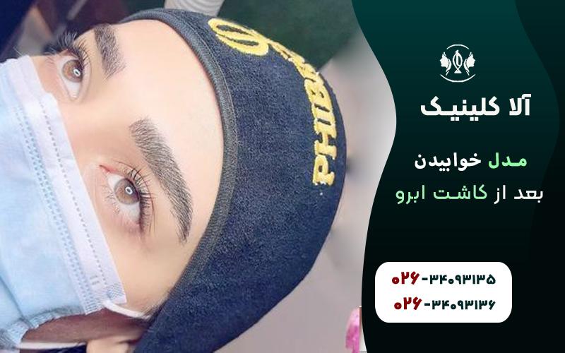 نحوه خوابیدن بعد از کاشت ابرو