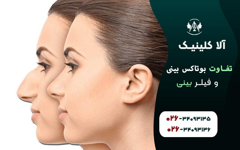 تفاوت بوتاکس بینی و فیلر بینی