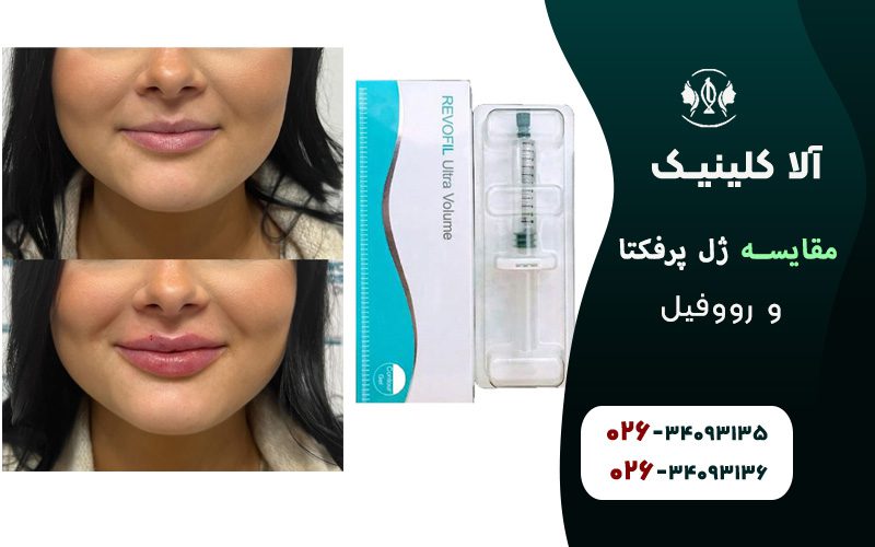 ژل رووفیل چیست؟