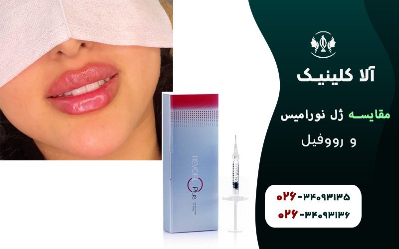 ژل رووفیل