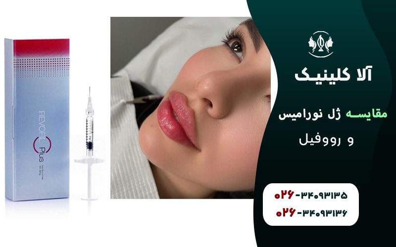 مقایسه ژل نورامیس و رووفیل