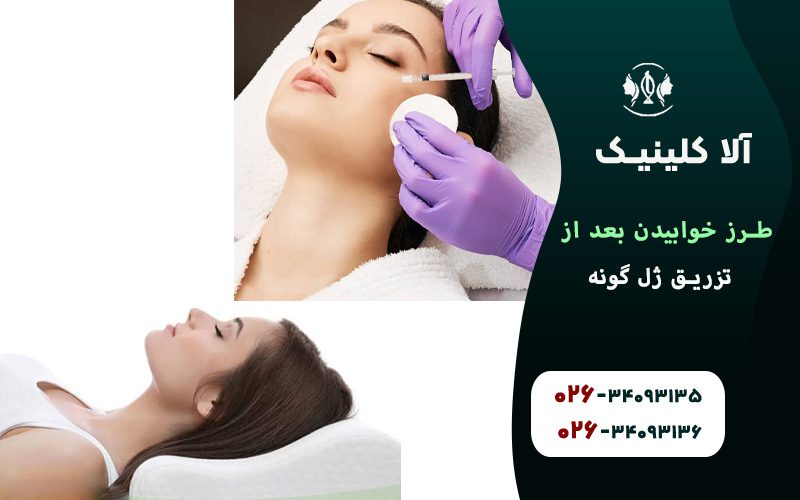 بهترین حالتهای خواب بعد از تزریق ژل گونه