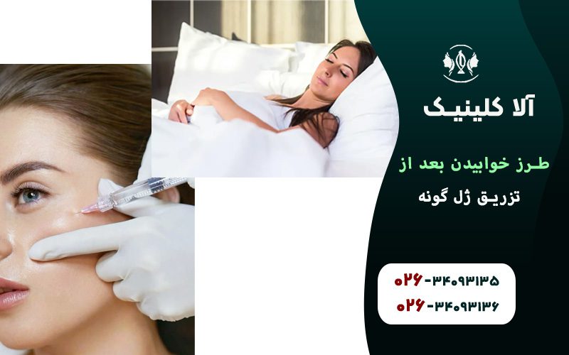طرز خوابیدن بعد از تزریق ژل گونه