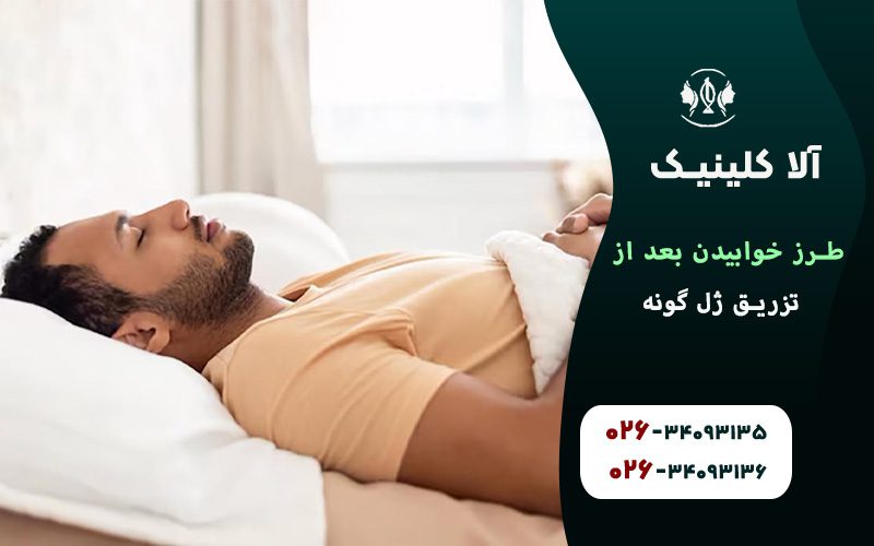 بهترین حالتهای خواب بعد از تزریق ژل گونه خوابیدن به پشت
