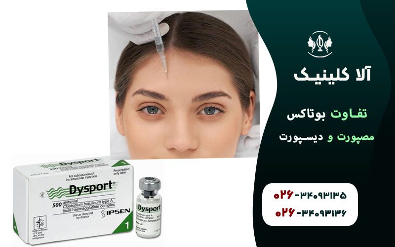 مزایا و معایب مصپورت و دیسپورت
