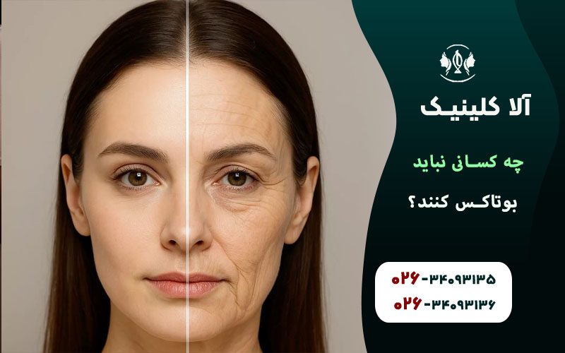 چه افرادی باید با احتیاط بوتاکس انجام دهند