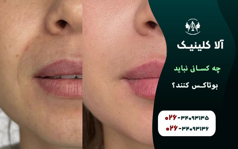 چگونه قبل از تزریق مطمئن شویم بوتاکس برای ما ایمن است