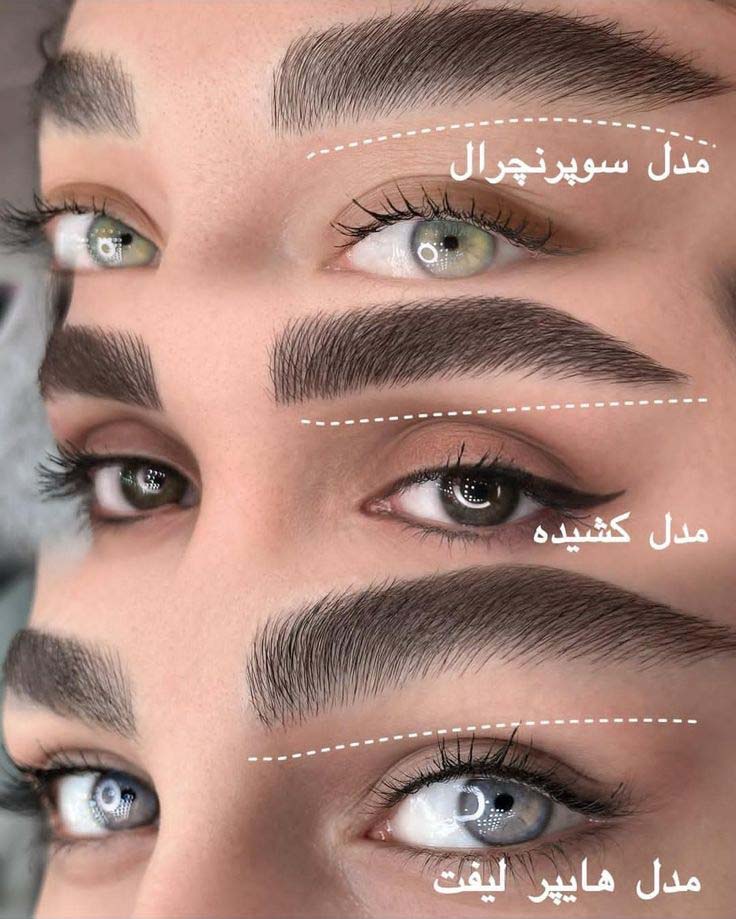 مدل های مختلف کاشت ابرو در کلینیک آلا کرج