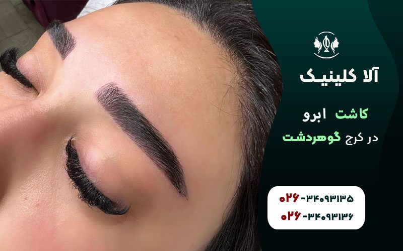 بهترین مرکز کاشت ابرو در کرج